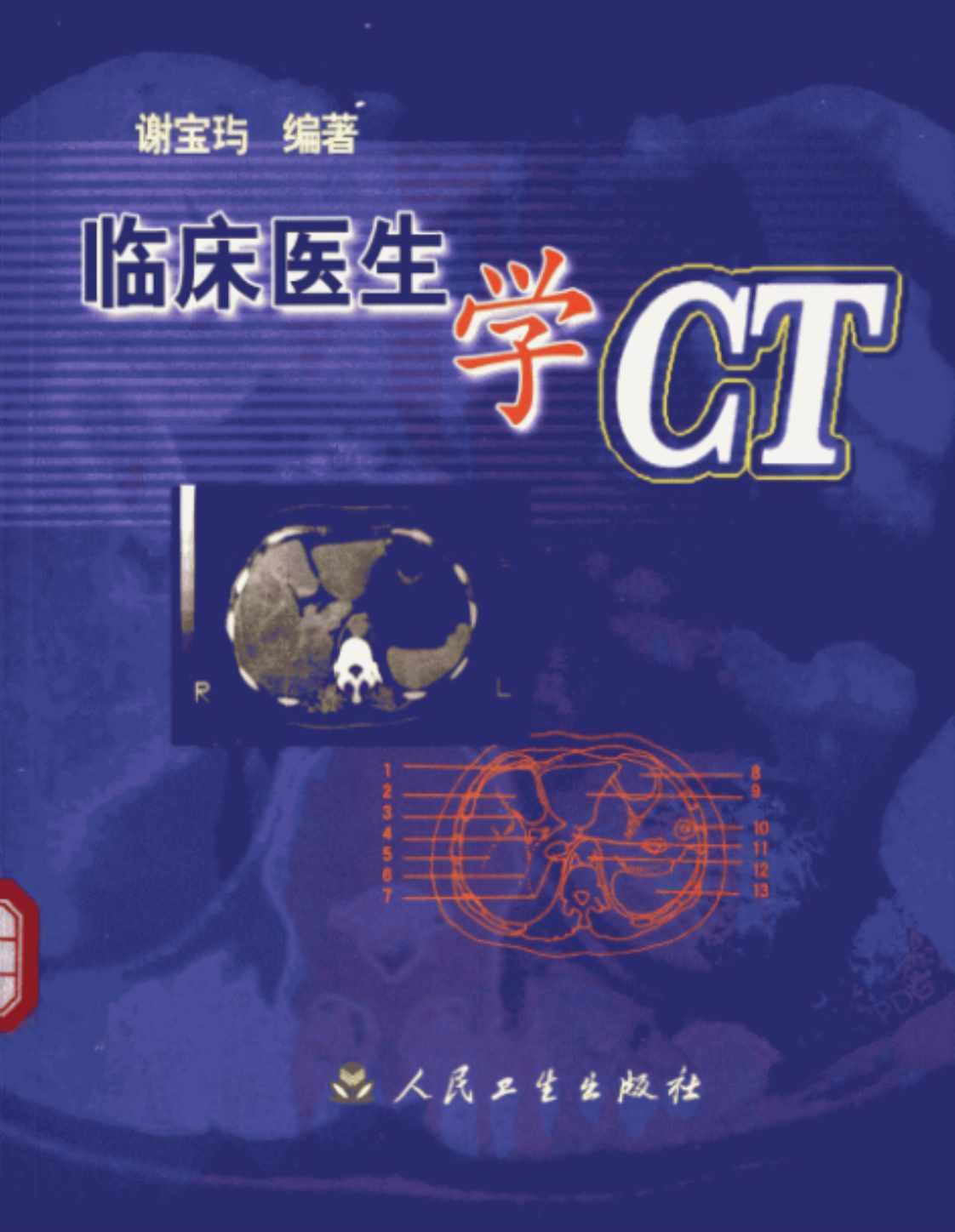 [临床医生学CT][谢宝玙（编著）]高清PDF电子书下载